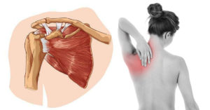 Почему больно поднимать руку вверх болит плечо. Лечение артрита плеча. Почему болит левое плечо? Это может быть опасным симптомом