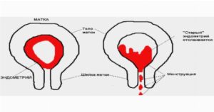 Причины и лечение сгустков крови в матке после родов. Сгустки после родов