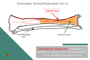 Воспаление надкостницы голени лечение мази. Особенности воспаления надкостницы голени и его лечение. Понятие и характеристика болезни