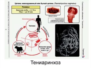 Пути заражения, симптомы и лечение бычьего цепня. Бычий цепень: симптомы, которые сигнализируют о заражении.