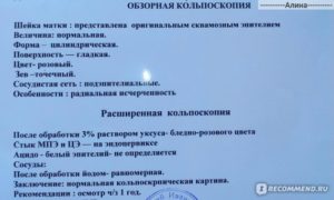 Сколько дней делается анализ после кольпоскопии. До и после кольпоскопии шейки матки: описание метода исследования