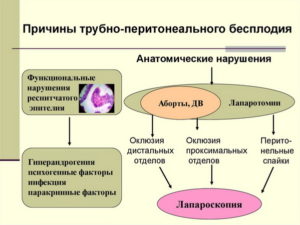 Трубно-перитонеальный фактор бесплодия. Трубный фактор и трубно-перитонеальное бесплодие. Методы лечения и ЭКО