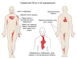 Чем снять сердечную боль в домашних условиях. Болит сердце: что делать