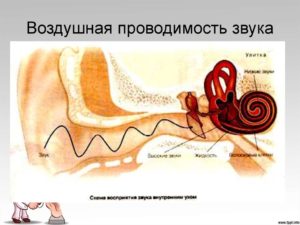 Воздушная проводимость звука. Могут ли навредить слуху