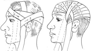 Как сделать повязку на голову из бинта. Наложение повязки на голову: особенности проведения процедуры