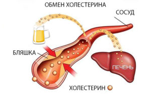 Курение, алкоголь и повышенный холестерин. Холестерин и его виды. Снижение уровня холестерина