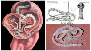Бычий цепень паразит в организме человека. Бычий цепень. Выявляем, избавляемся, выполняем необходимую профилактику