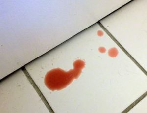 Щенок писает с капельками крови. Что делать, если заметили у собаки кровь в моче