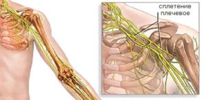 Невролиз нерва. Невролиз нерва Туннельные поражения нервов и сплетений