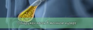 Как вывести песок в желчном пузыре: медикаментозные и нетрадиционные методы лечения