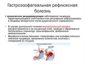 Симптомы и лечение гастроэзофагеальной рефлюксной болезни. Заброс желудочной кислоты в пищевод: причины, диагностика, лечение