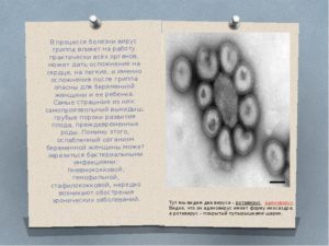Осложнение на сердце после гриппа. Возможные осложнения на сердце после гриппа
