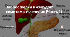 Почему выделяется много желчи. Почему попадает желчь в желудок: симптомы и лечение