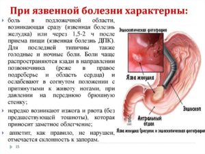 Остановка желудка симптомы и причины. Причины возникновения и признаки непроходимости желудка