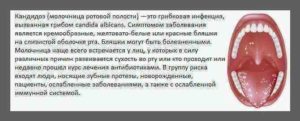 Пятна на верхнем небе у ребенка. Что означает красная сыпь на небе у ребенка. Характерные особенности заболевания