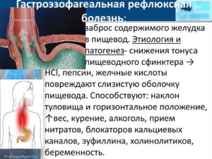 Симптомы и лечение гастроэзофагеальной рефлюксной болезни. Заброс желудочной кислоты в пищевод: причины, диагностика, лечение