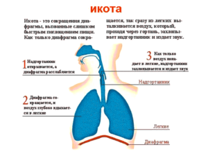 Причины и лечение частой икоты у взрослых. Почему человек икает