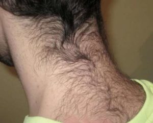 Неравномерный рост волос на груди мужчины. Зачем человеку волосы на ногах? Почему растут волосы на ногах