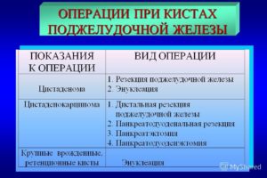 Сколько живут без поджелудочной железы. Удаление поджелудочной железы: показания к проведению, виды операции, последствия