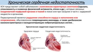 Большое сердце болезнь лечение. Диагноз большое сердце что это такое. Причины роста размеров сердца