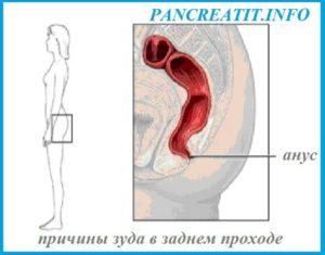 Почему чешется сфинктер. Причины зуда в заднем проходе