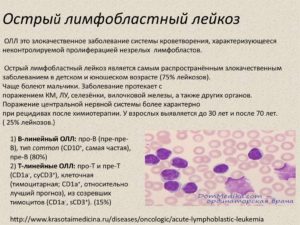 Острый лейкоз у собак симптомы. Лейкоз у собак. Особенности заболевания, его симптомы и лечение. Диагностика острых лейкозов