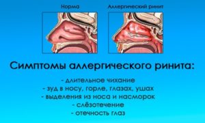 Причины и лечение постоянного зуда носа снаружи. Зуд в носу, чихание, насморк — о чем говорят симптомы