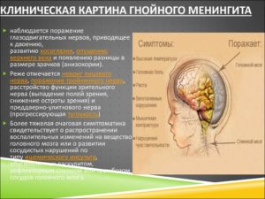 Инфекционные заболевания головного мозга: лечение и симптомы. Нейроинфекция у детей - что это и как бороться