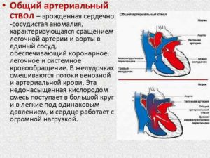 Общий артериальный ствол: описание, заболевания, лечение. Врожденные пороки сердца: общий артериальный ствол