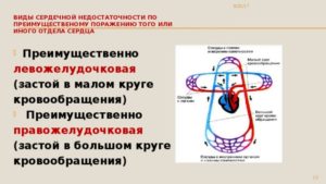 Умеренные застои в мкк лечение народные способы. Как лечить венозный застой и не допустить развитие заболевания? Причины острой сердечной недостаточности