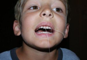 Чем вырвать молочный зуб. Как выдернуть молочный зуб ребенку в домашних условиях без боли