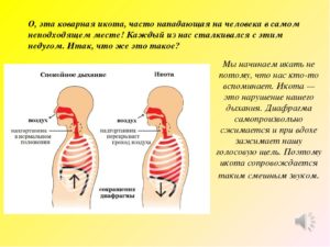 Икота после еды у взрослых. Что делать, если мучает икота после еды