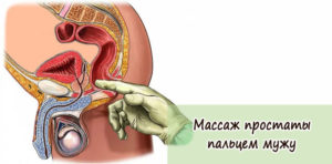 Как сделать массаж предстательной железы дома. Массаж простаты дома — за и против