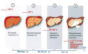 Гепатит С — как передается, симптомы, первые признаки, осложнение, лечение и профилактика гепатита Ц. Влияет ли гепатит с на потенцию Гепатит с на что влияет