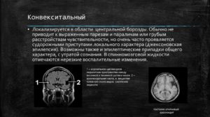 Расширение конвекситальных ликворных пространств. Что представляет собой субарахноидальное пространство