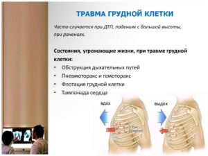 Что делать если ударили по груди. Опасные симптомы ушиба грудной клетки: важно знать