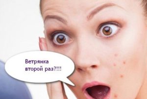 Можно ли переболеть ветрянкой 2 раза. Ветрянка второй раз. Это возможно