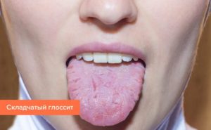 Почему возникает вязкость во рту: причины, как устранить неприятное ощущение, если вяжет язык