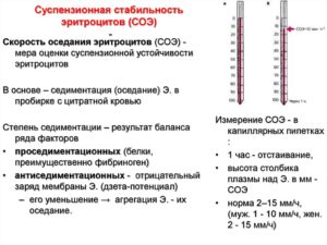 Народные средства для понижения соэ в крови. Как снизить СОЭ в крови у женщин — эффективные методы. Причины повышения СОЭ