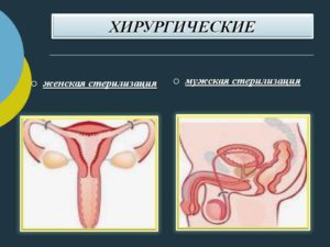 Женская стерилизация плюсы и минусы. Показания к стерилизации женщин. Кто может использовать трубную окклюзию
