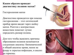 Когда можно делать узи после удаления полипа. Лечение и восстановление здоровья после удаления полипа эндометрия в матке