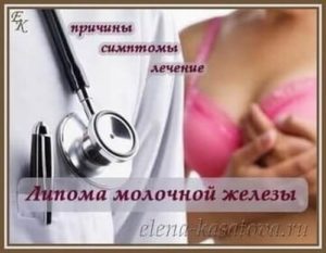 Может ли липома молочной железы быть раком? Липома молочной железы: причины, симптомы и методы лечения. Липома молочной железы: лечение народными средствами