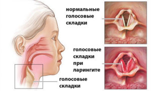 Чем лечить воспаление голосовых связок у собак. Ларингит у собак: как уберечься от болезни, и можно ли вылечить народными средствами. Лечение ринита у собаки