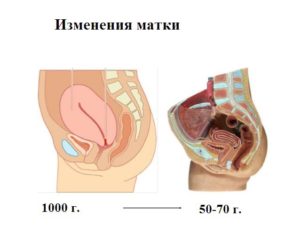 Сколько по времени сокращается матка после. Этапы сокращения матки. Как проявляются сокращения матки