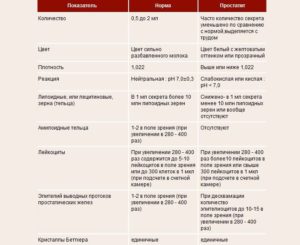 Подготовка к взятию секрета простаты. Анализ сока простаты – показания к проведению. Как проходит процедура взятия секрета простаты