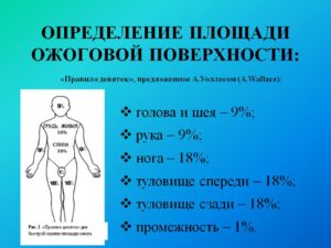 Ожоги: площадь ожогов, определение по правилу ладони. Классификация ожогов по площади и степени поражения. Методы определения площади ожога