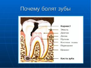 Почему к ночи начинает болеть зуб. Почему зубная боль усиливается только вечером и ночью в положении лежа, а днем — нет? Почему зубная боль усиливается только вечером и ночью в положении лежа, а днем - нет