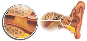 Почему в ушах у взрослого образуется много серы. Почему в ушах образуется много серы