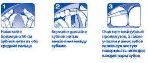 Как пользоваться зубной нитью. Когда чистить зубной нитью - до или после чистки зубов щеткой? Как правильно это делать? Инструкция по чистке зубов нитью