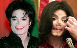 Почему майкл джексон был белым. Разрушаем мифы о Майкле Джексоне. Почему кожа Майкла Джексона побелела